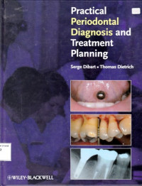 Practical Periodontal Diagnosis And Treatment Planning