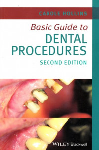 Basic Guide to Dental Procedures