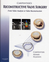 Reconstructive Valve Surgery : From Valve Analysis to Valve Reconstruction