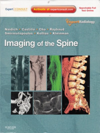 Imaging of the Spine