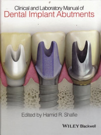 Clinical and L:aboratory Manual of Dental Implant Abutments