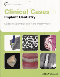 Clinical Cases in Implant Dentistry