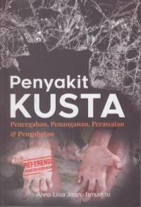 Penyakit Kusta: Pencegahan, Penanganan, Perawatan Dan Pengobatan