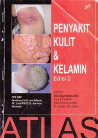 Penyakit Kulit Dan Kelamin Edisi 2