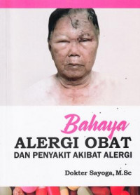 Bahaya Alergi Obat Dan Penyakit Akibat Alergi