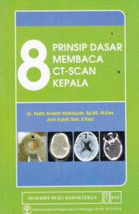 8 Prinsip Dasar Membaca CT-SCAN Kepala