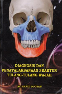 Diagnosis Dan Penatalaksanaan Fraktur Tulang-Tulang Wajah