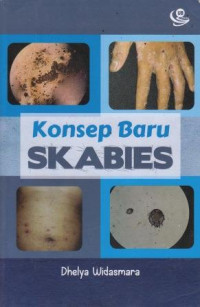 Konsep Baru Skabies