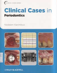 Clinical Cases in Periodontics