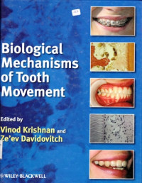 Biological Mechanisms of Tooth Movement