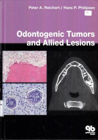 Odontogenic Tumors And Allied Lesions