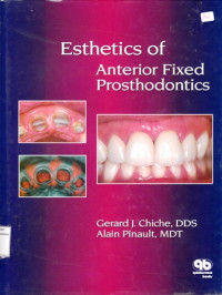 Esthetics of Anterior Fixed Prosthodontics