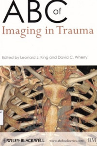 ABC of Imaging In trauma