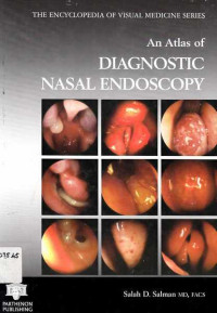 An Atlas of Diagnostic Nasal Endoscopy