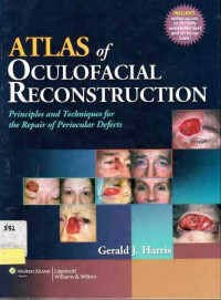 Atlas of Oculofacial Reconstruction