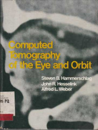 Computed Tomography Of The Eye And Orbit