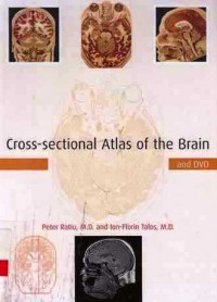 Cross-Sectional Atlas of the Brain