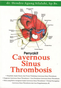 Penyakit Cavernous Sinus Thrombosis