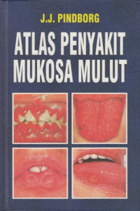 Atlas Penyakit Mukosa Mulut