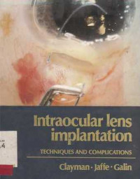 Intraocular Lens Implantation  Techniques And Complications