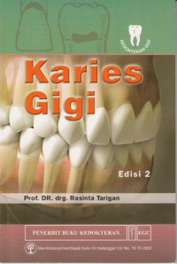 Karies Gigi