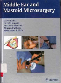 Middle Ear And Mastoid Microsurgery