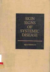 Skin Signs Of Systemic Disease