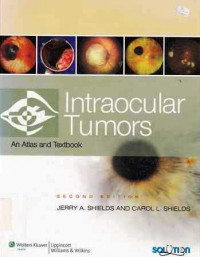 Intraocular Tumors : An Atlas And Textbook