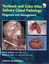 Textbook and Color Atlas of Salivary Gland Pathology:Diagnosis and Management