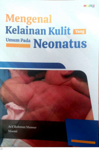 Mengenal Kelainan Kulit Yang Umum Pada Neonatus