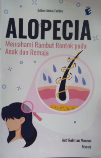 Alopecia: Memahami rambut rontok pada anak dan remaja