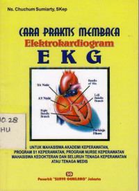 Cara Praktis Membaca Elektrokardiogram (EKG)