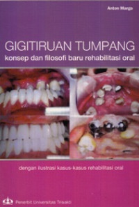 Gigitiruan Tumpang:Konsep dan Filosofi Baru Rehabilitasi Oral