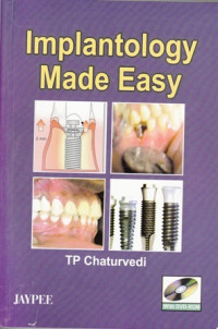 Implantology Made Easy