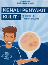 Kenali Penyakit Kulit : Skabies & Tinea Corporis