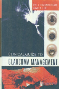 Clinical Guide To Glaucoma Management