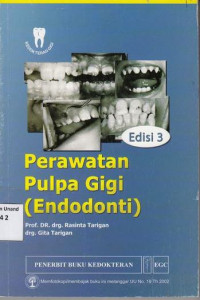 Perawatan Pulpa Gigi Endodonti